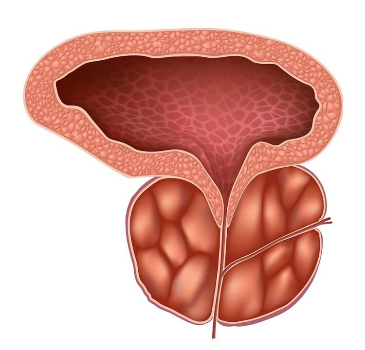 zapalenie gruczołu krokowego